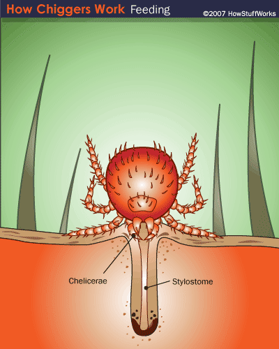 Chiggers and Trombiculosis2